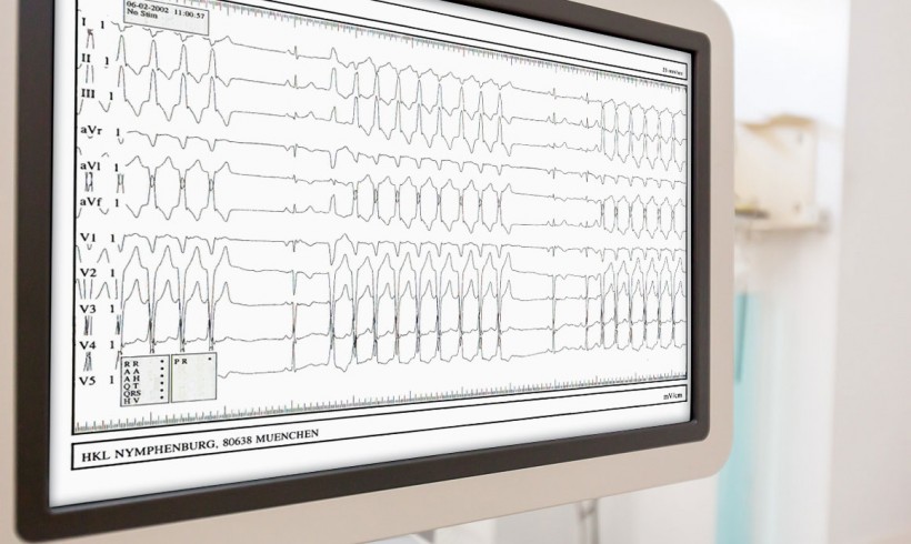 Elektrophysiologie / Katheterablation