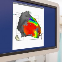 Elektrophysiologie / Katheterablation