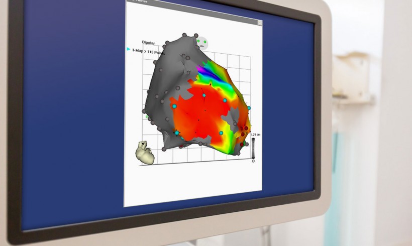 Electrophysiology / Catheter ablation